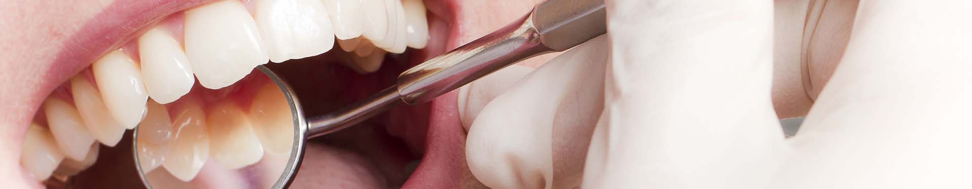 Wurzel­kanal­behand­lung (Endodontie)